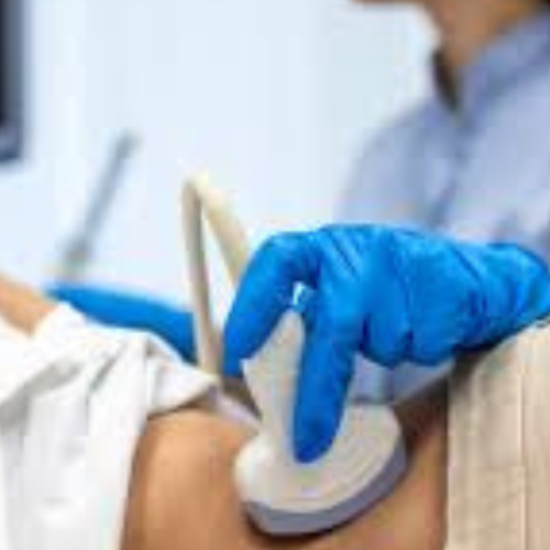 The Impact of Kidney Disease on Health What You Need to Know